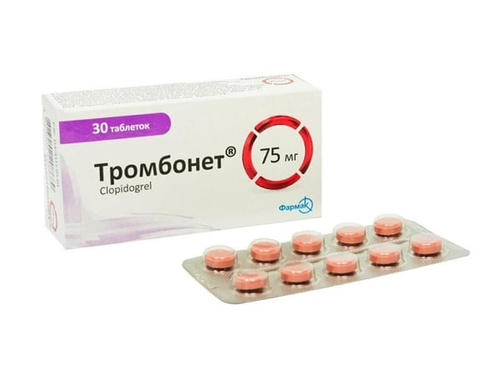 Ціни на Тромбонет табл. в/о 75 мг №30 (10х3)
